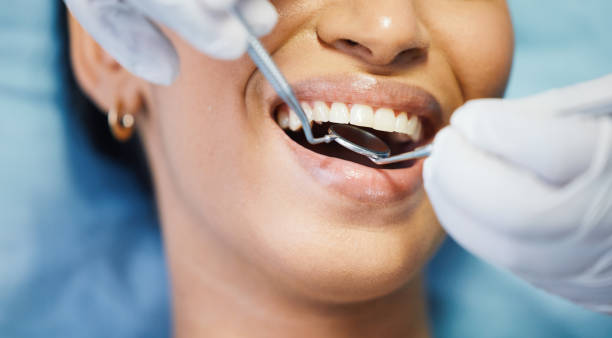 Best Emergency Cosmetic Dentistry in Elk Point, SD