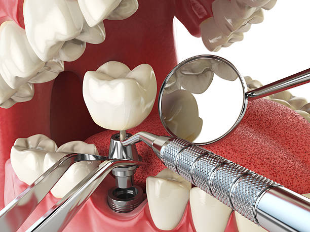 Best Emergency Dentist for Knocked-Out Tooth in Elk Point, SD